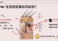 NiceTop所先养发胶囊双管齐下 从根源解决脱发难题